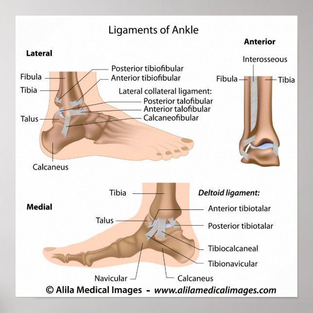 Ankle-ligament, märkt teckning. poster (Framsidan)