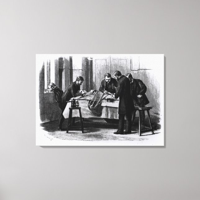 Antiseptisk kirurgi, 1882 canvastryck (Framsida)