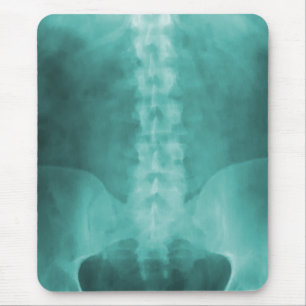 Aqua Digital röntgar konst Mousepad Musmatta