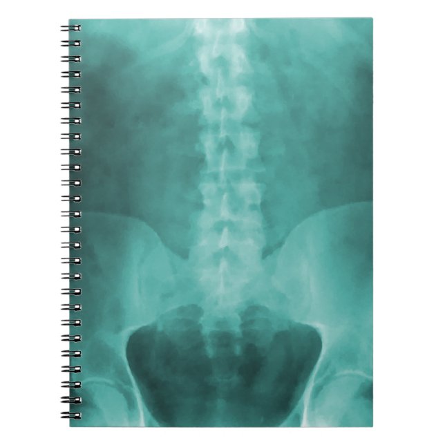 Aqua Digital X-Ray Art bärbar dator Anteckningsbok (Framsidan)