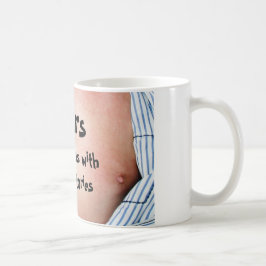 Ärr är tatueringar med bättre stories. kaffemugg