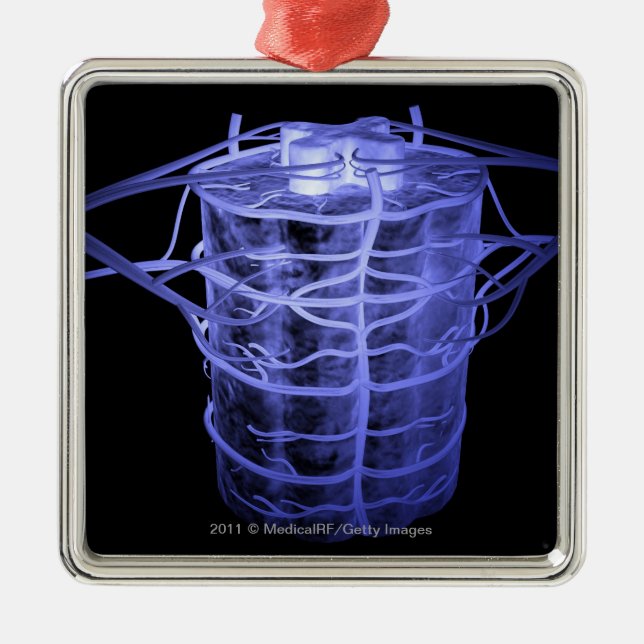 Artärer som omger del av den ryggrads- kolonnen julgransprydnad metall (Framsidan)