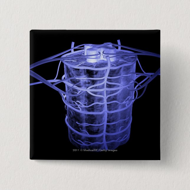 Artärer som omger del av den ryggrads- kolonnen knapp (Framsida)