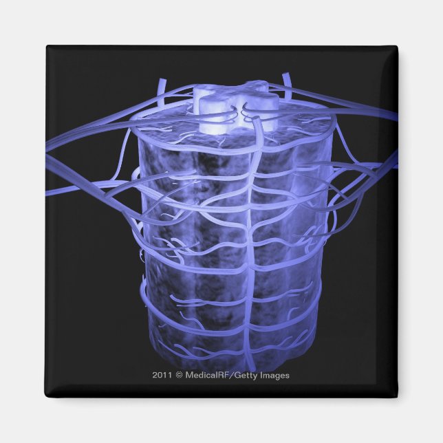 Arterier som omger en del av ryggraden magnet (Framsidan)