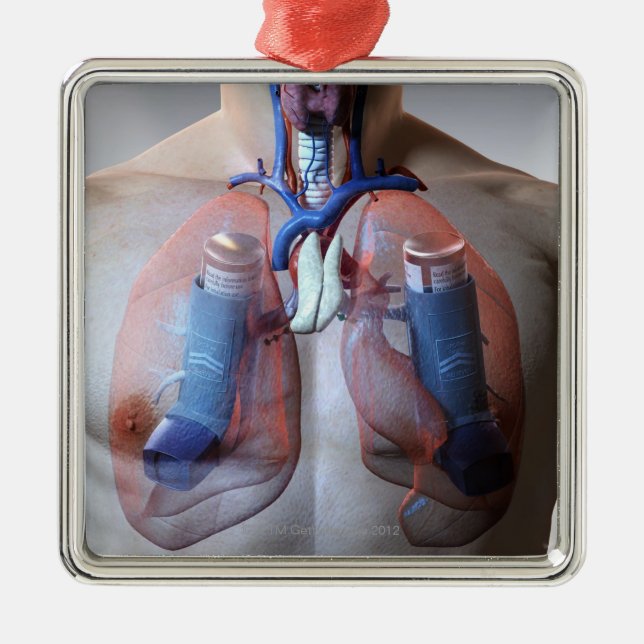 Astma Julgransprydnad Metall (Framsidan)