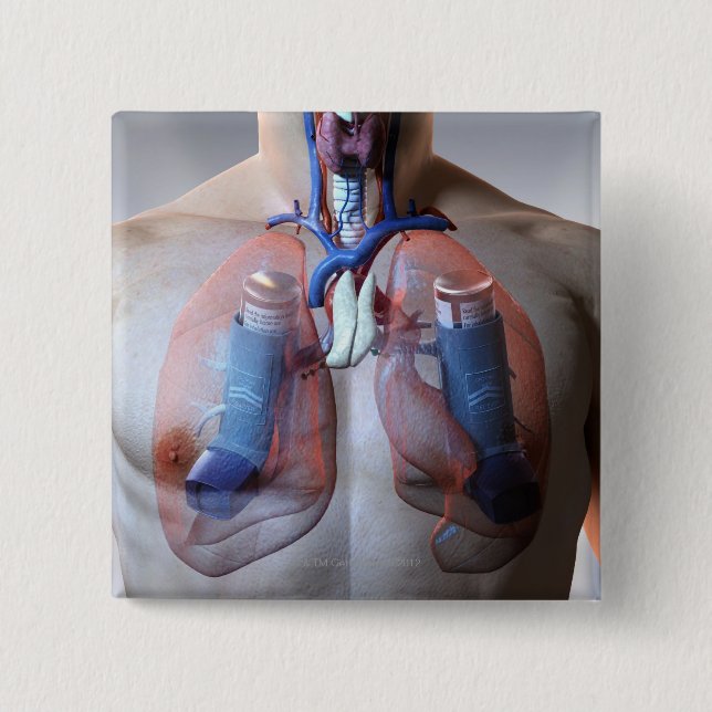 Astma Knapp (Framsida)