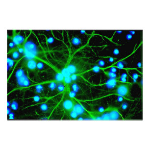 Astrocyte är stjärnan formade Glial celler i Fototryck