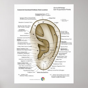 Aurikuloterapi Öronakupunktur Poster