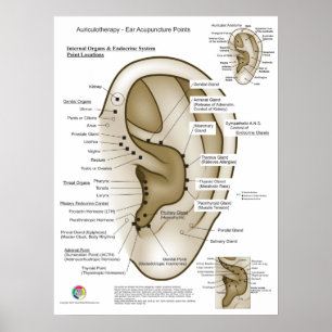 Aurikuloterapibehandling Öronakupunktur Poster