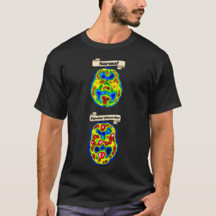 av Normal kontra bipolär hjärnavsökning T Shirt