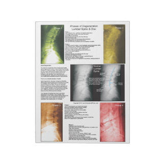 Avaktivering av ryggstödet på stödslister anteckningsblock