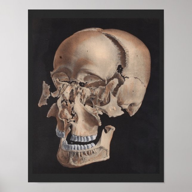 Avledad utskrift av uppdelat skal poster (Framsidan)