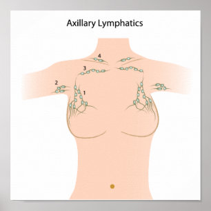 Axillary lymfaknutpunktaffisch poster