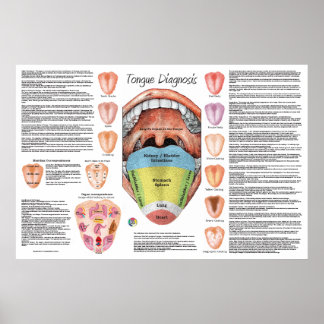 Ayurvedic Tunga Diagnosis Karta Poster