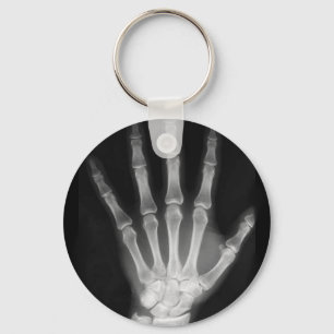 B&W röntgenskelleton Hand Nyckelring