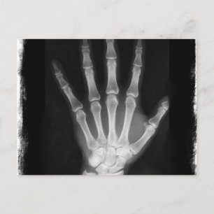 B&W röntgenskelleton Hand Vykort