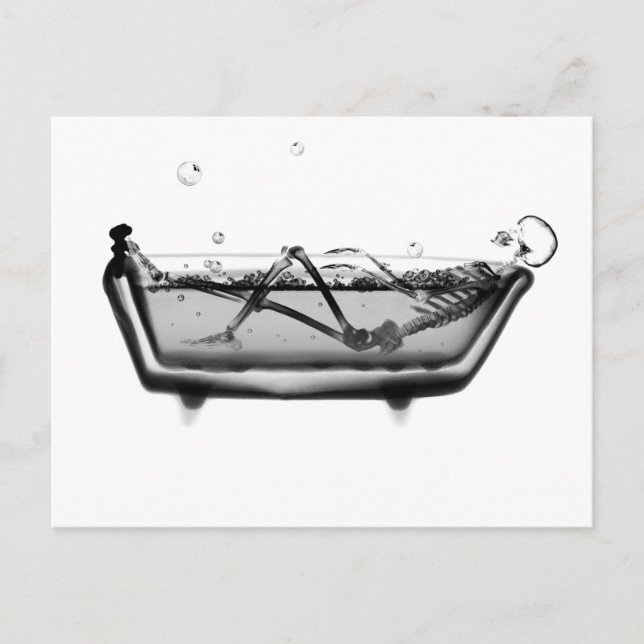 B&W X-Ray Skeleton i Bath Tub Vykort (Framsida)