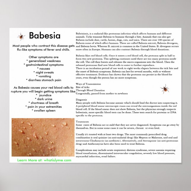 Babesia Symptomes and Transmission Poster (Framsidan)