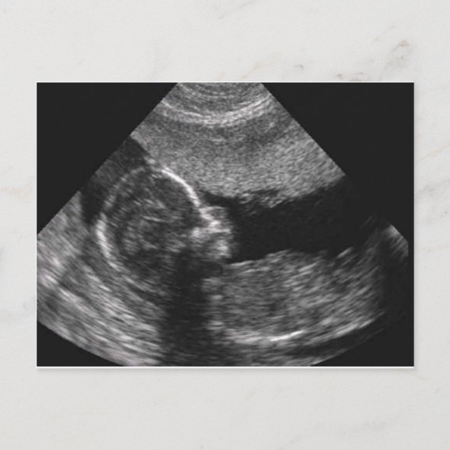 baby ansikte,kort vykort (Framsida)