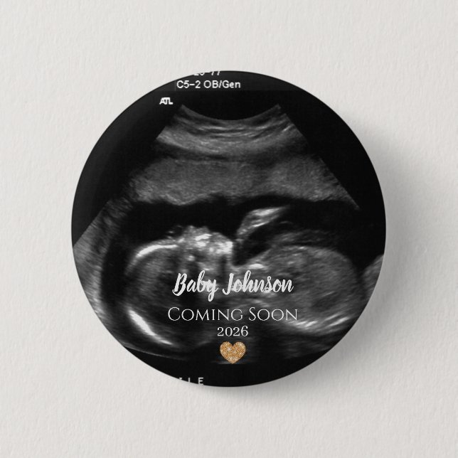 Baby Coming Soon Ultrasound Gold heart  Knapp (Framsida)