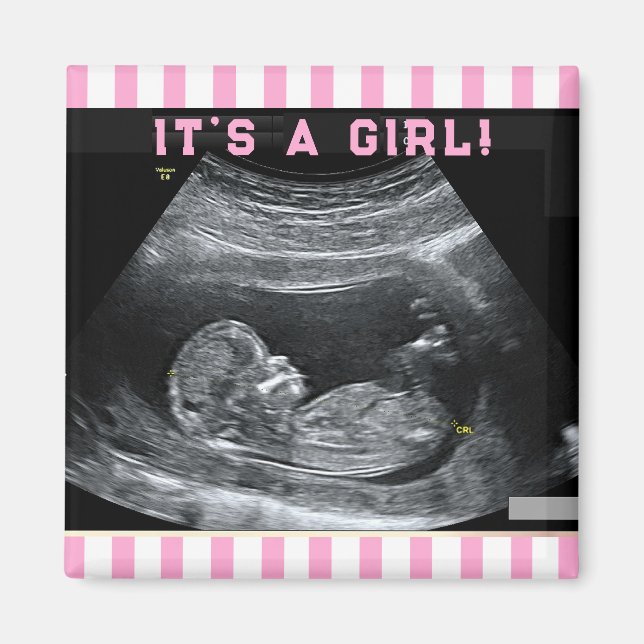 Baby First Photo Magnet (Framsidan)