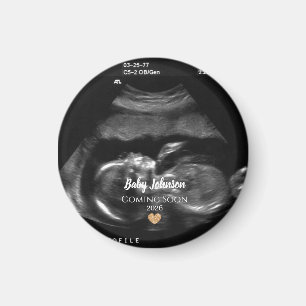 Baby Kommer Snart Sonogram-kunngörande Magnet