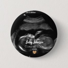 Baby Kommer Snart Ultraljud Guld hjärta Knapp