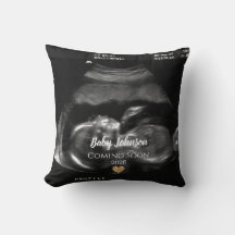 Baby kommer snart Ultralound Guld hjärta