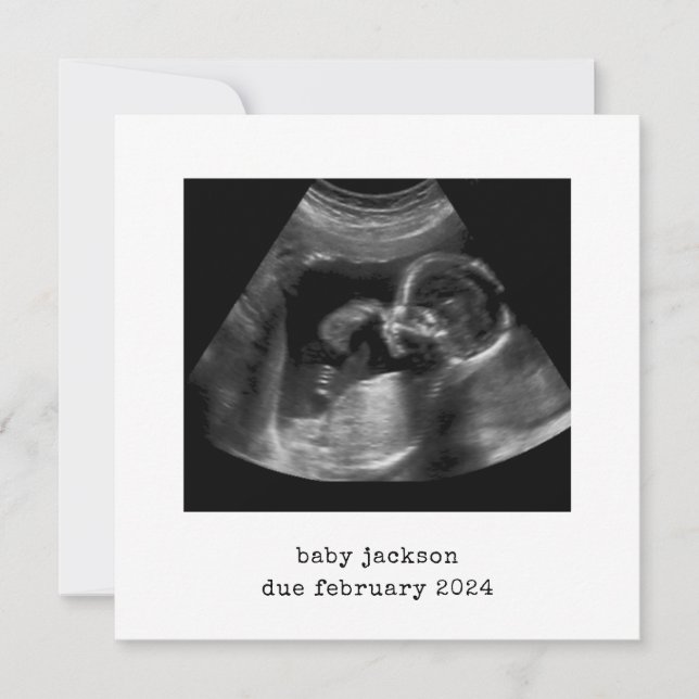 Baby Scan Photo annonscertifikat Julkort (Framsida)