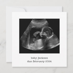 Baby Scan Photo annonscertifikat Julkort