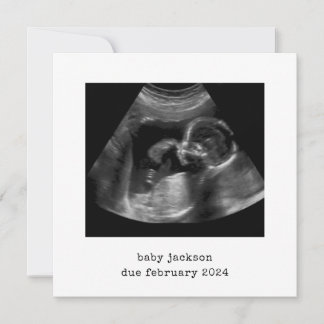Baby Scan Photo annonscertifikat Julkort