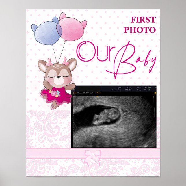 Baby Shower. Rosa Baby Hjort Poster (Framsidan)