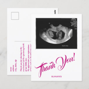 Baby Shower Ultrasound Girl Tack Rosa. Vykort