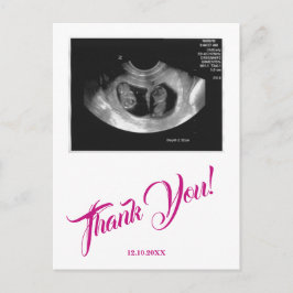 Baby Shower Ultrasound Girl Tack Rosa. Vykort