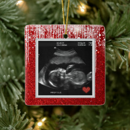 Baby Ultraljud kommer snart Photo Julgransprydnad Keramik