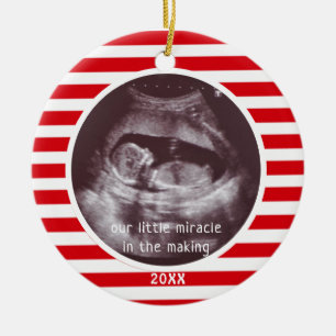 Baby Ultraljudsfoto Rött vitt Rand Julgransprydnad Keramik