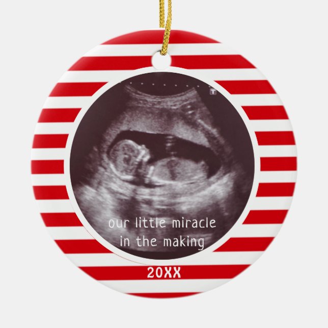 Baby Ultrasound Photo Red White Rand jul Julgransprydnad Keramik (Framsidan)