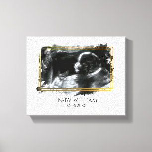 Baby Ultrasound Sonogram Bild väntar på