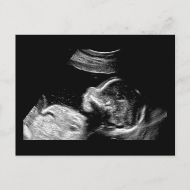 Baby Vykort (Framsida)