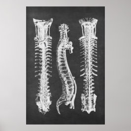 Backbone Vertebrae Anatomy Skriv ut nr 2 Poster