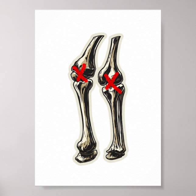 Bad Knees – Funny Skeleton Knee Illustration Poster (Framsidan)