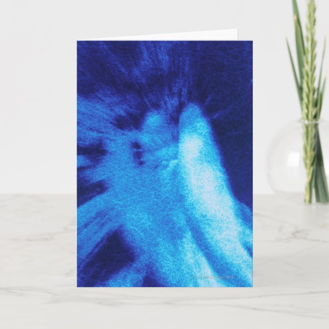 Baksidaen beskådar av ängelskulptur, knastrar kort (Framsida)