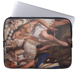 Ballerinas i doseringsrummet (av Serebriakova) Laptop Fodral