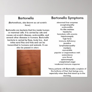 Bartonella Symptoms Education Poster