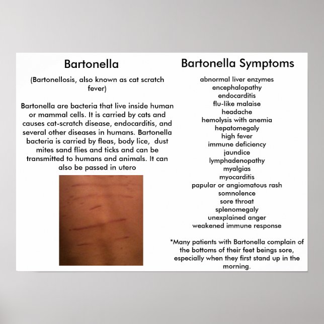 Bartonella Symptoms Education Poster (Framsidan)