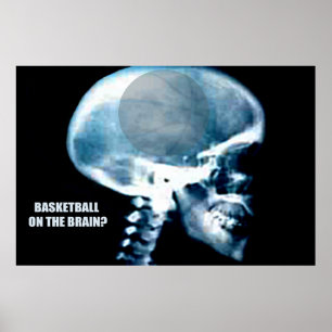 Basketboll huvud (röntgenstråle) poster