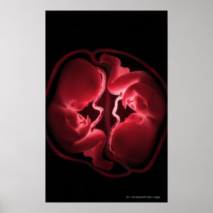 Begreppsmässigt avbilda av ett sköte som poster