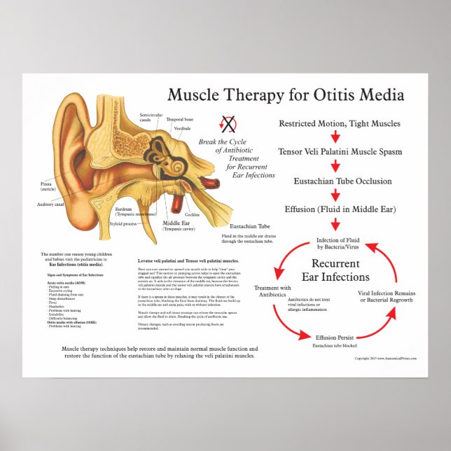 Behandling av muskelmassage vid Otitis Media Poster (Framsidan)
