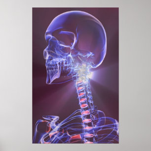 Ben av huvudet och nacken 5 poster