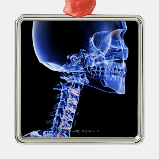 Ben av huvudet och nacken julgransprydnad metall (Framsidan)